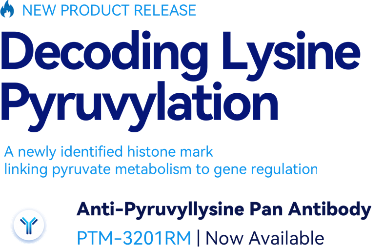 Decoding Lysine Pyruvylation